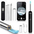 Ear Wax Camera Cleaning Device – Safe and Easy Ear Cleaning Solution